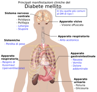 Principali_manifestazioni_cliniche_diabete